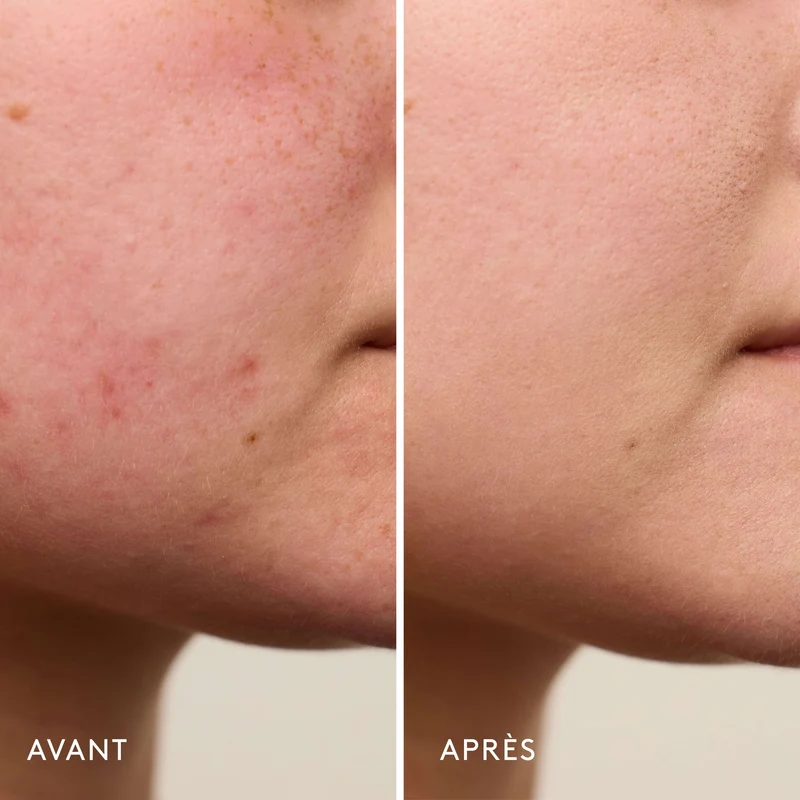 Invisible Bandage Gel Apaisant & Réparateur