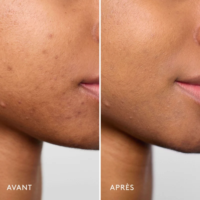 Invisible Bandage Gel Apaisant & Réparateur