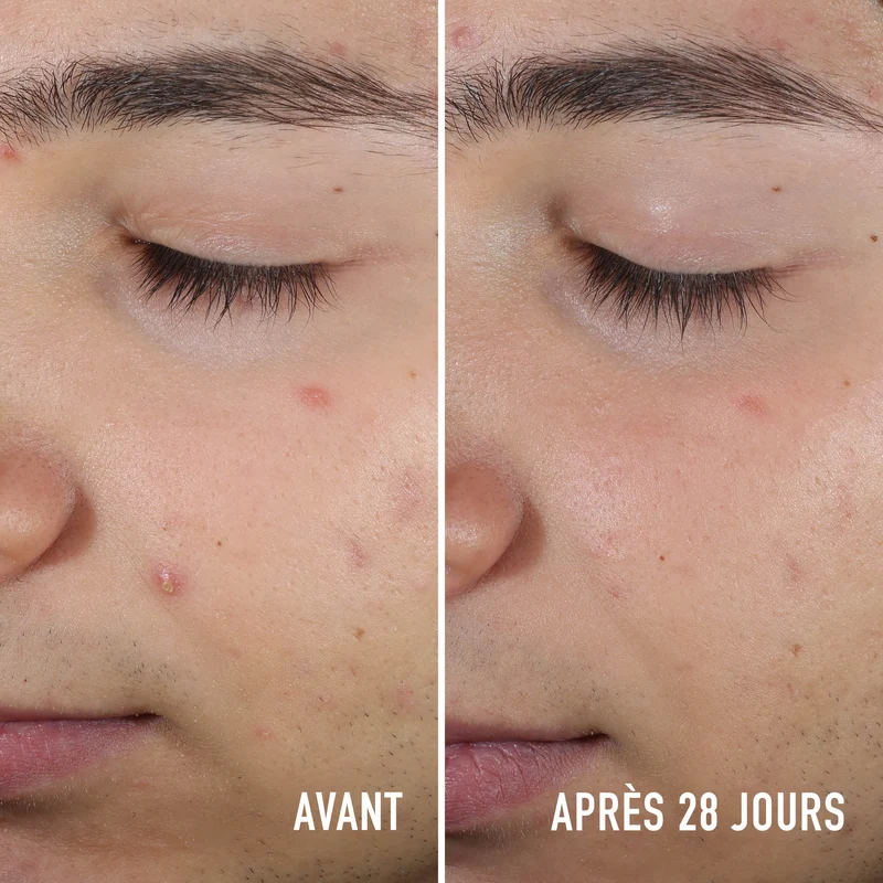 Sérum Anti-Imperfections