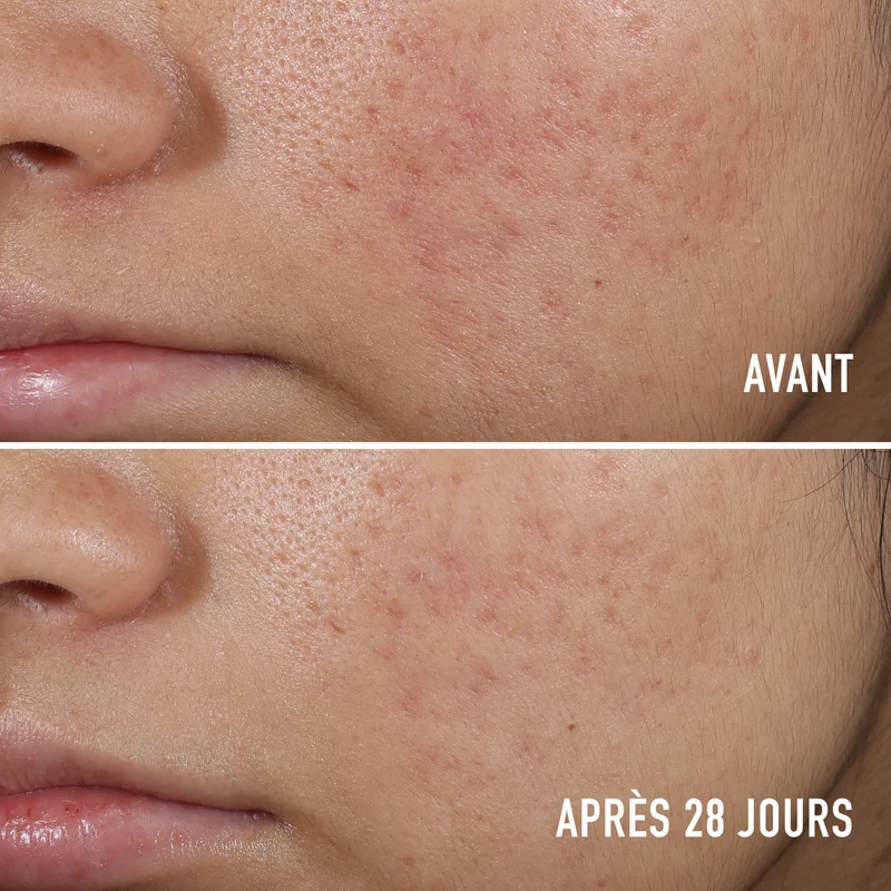 Sérum Anti-Imperfections