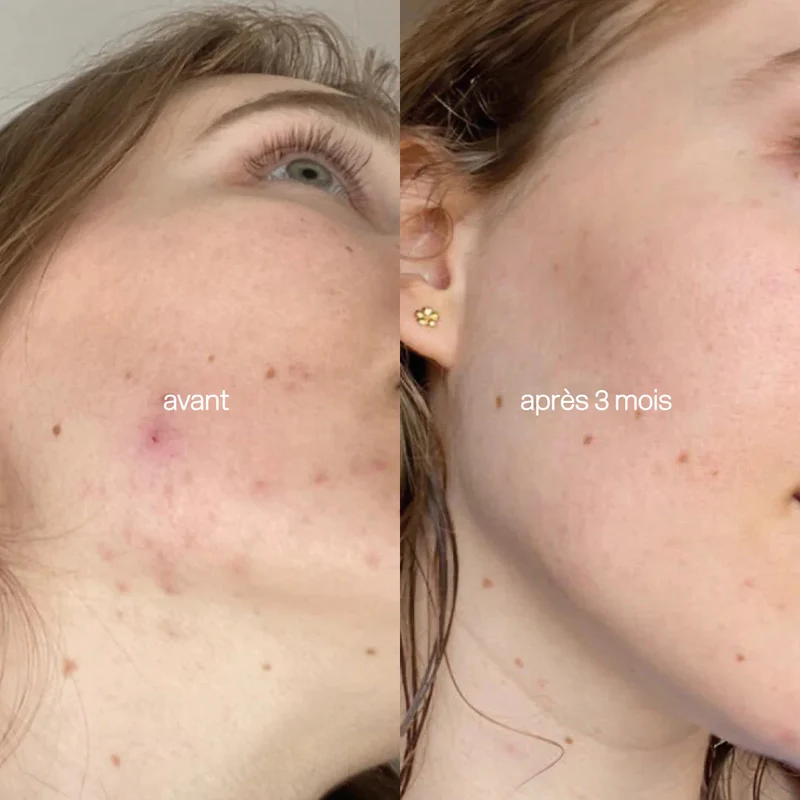 L'Essentiel Peau Cure de 3 mois