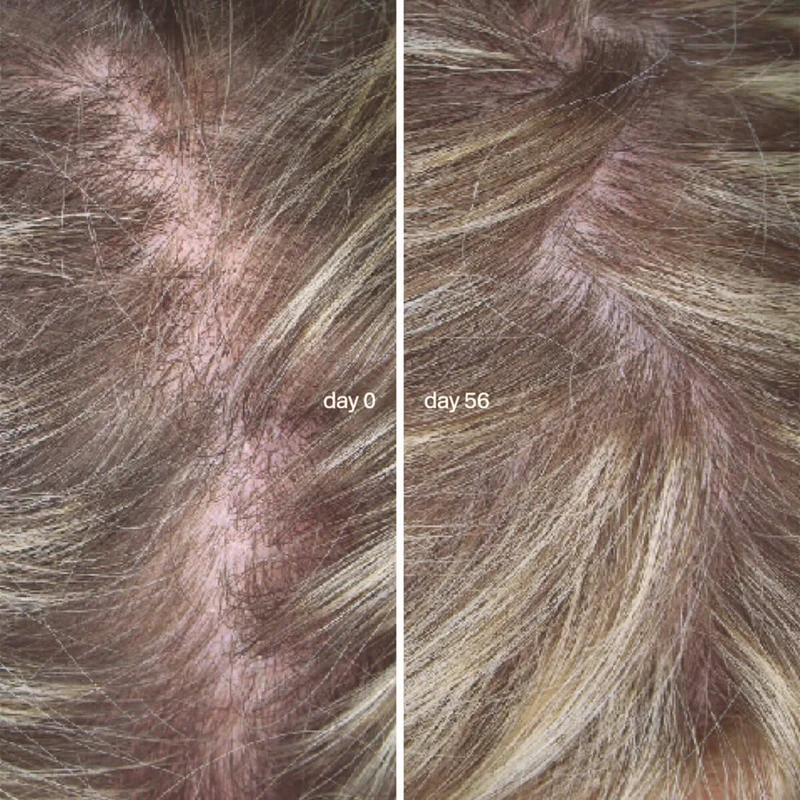L'Essentiel Cheveux Cure de 3 mois