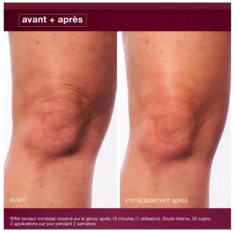 Dynamic Skin Sculptor Sérum Corps