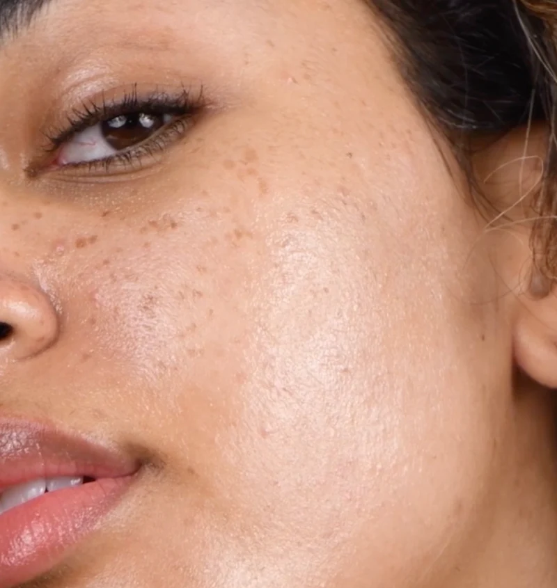 Good Genes All-In-One Lactic Acid Treatment Sérum
