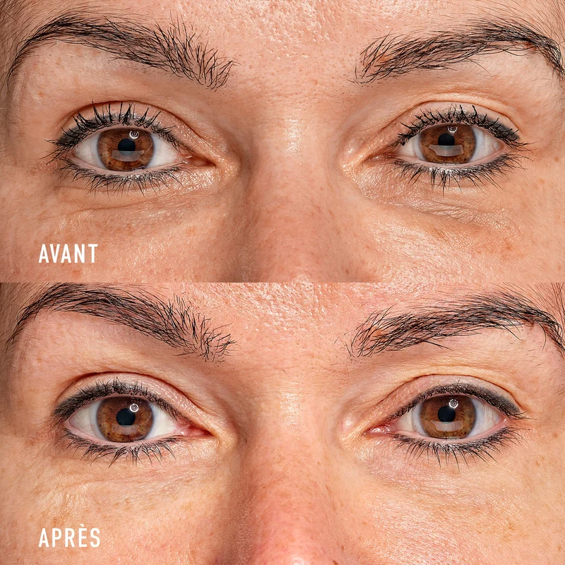Eye Recipe Soin Contour des Yeux Global