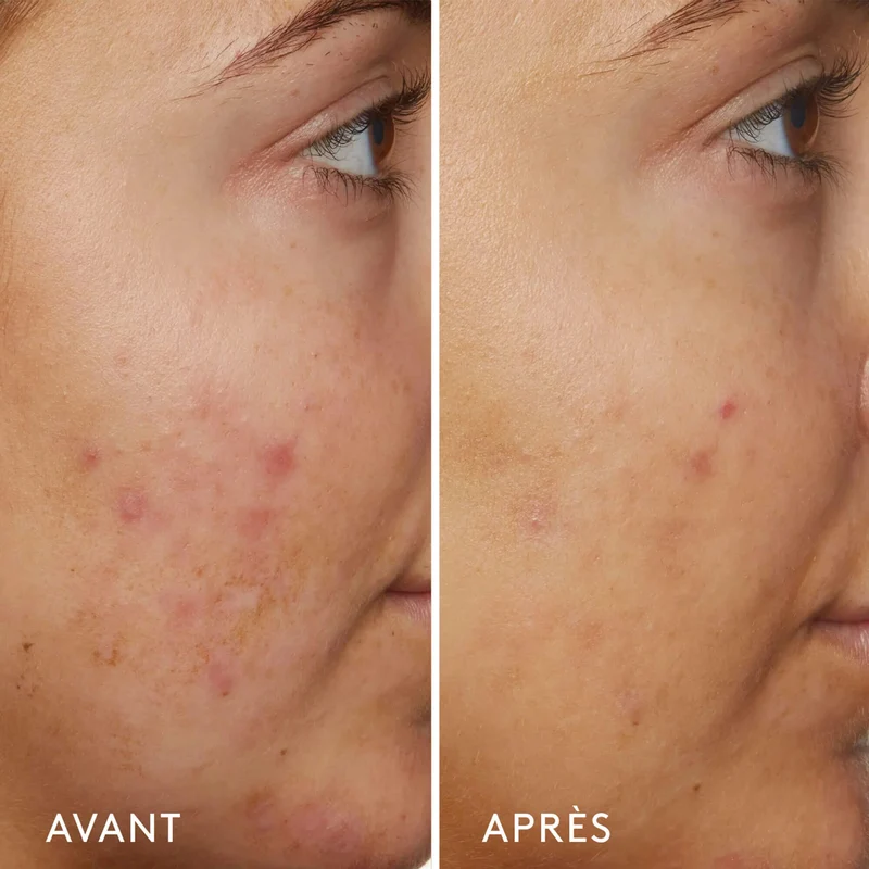 B3 Nice 10% Niacinamide Sérum Rééquilibrant