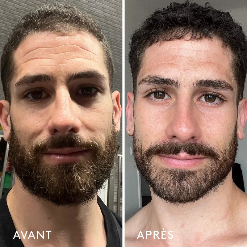 Complément Alimentaire Repulpant