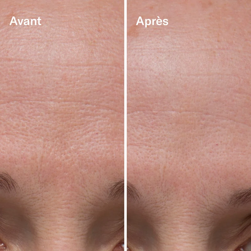 Clean-ical Renewing Serum Sérum Rénovant
