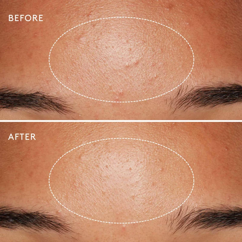 Daily Microfoliant Exfoliant Poudre
