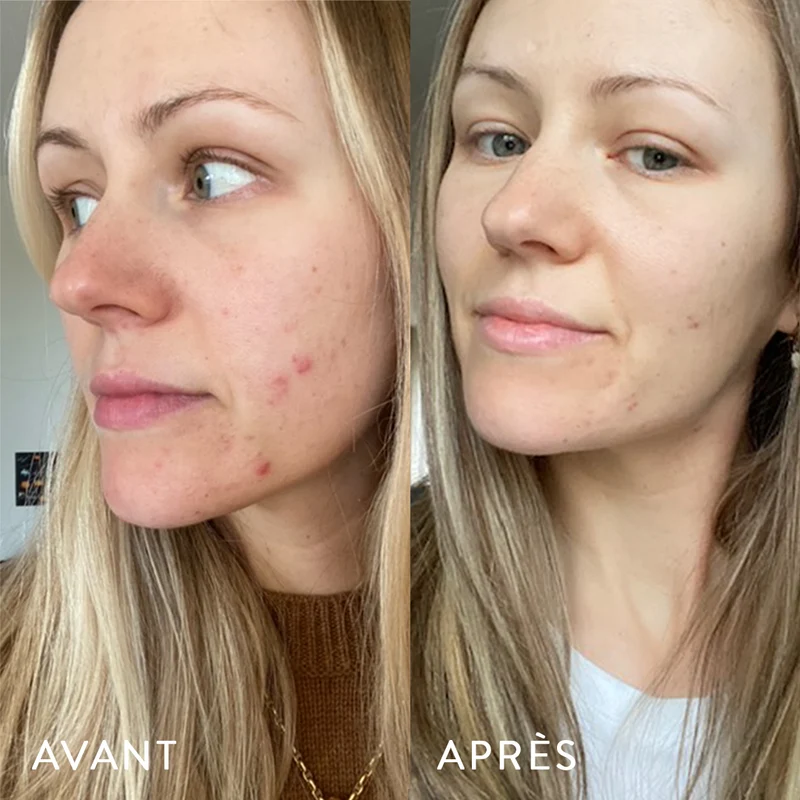 Microbiote & Peau